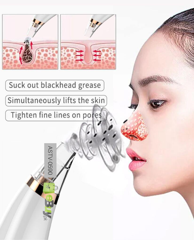 Blackhead Removal Machine Derma Suction 5 In 1 Black Head Remover Machine Acne Pimple Pore Cleaner Vacuum Tool Rechargeable